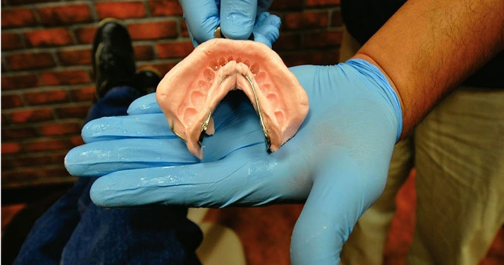 8 Keys to a Beautiful Alginate Impression Directorio Odontológico