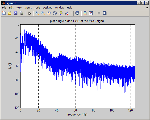 Biomedical Signal and Image Processing projects using Matlab and