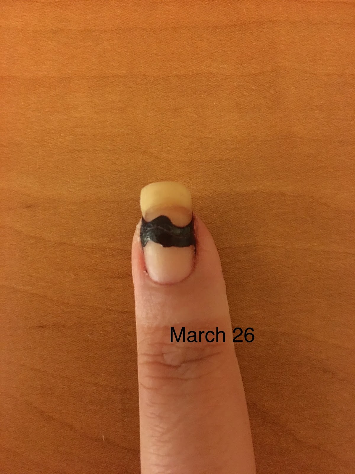 How To Save And Regrow Nails After A Break I Had A Super Low Break On My Right Ring Finger Who Knew You Could Totally Rip Up Your Nail Leaning Diner Bench To Pick