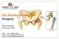 Hip Replacement Treatment in India:
