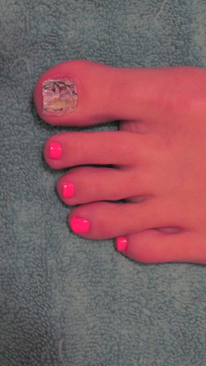 Nail Polish Strips For Toes@^*
