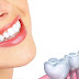 Quy trình trồng răng tại nha khoa