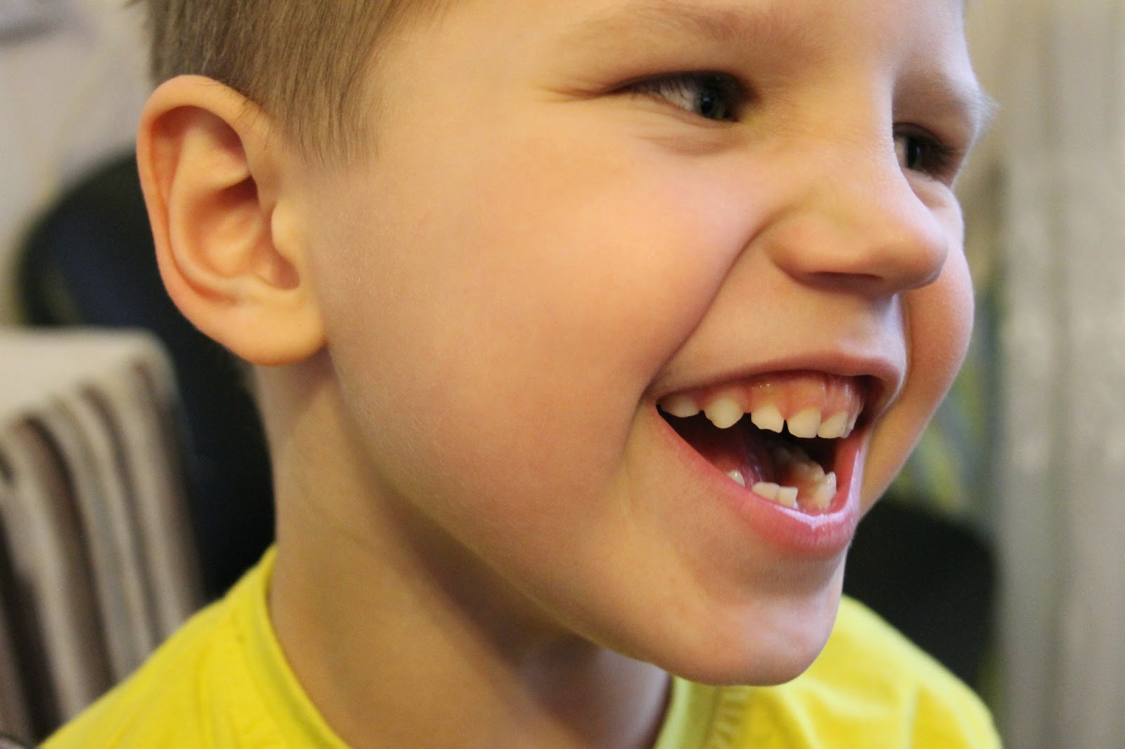 Сонник выпадение зубов без. Выпадение зубов у детей фото.