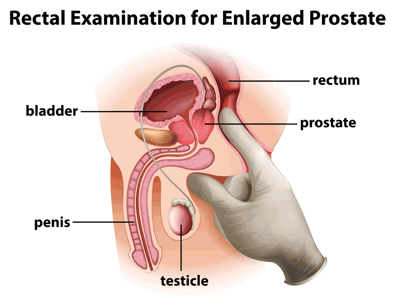 itching and prostate Anal