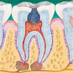Pulpa Dental 