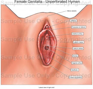 Vagina Hymen 10