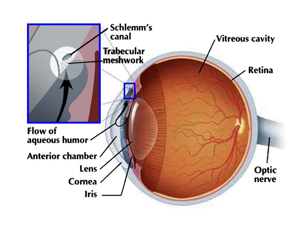 ChyntiaBlog Modul Mata Glaukoma Akut
