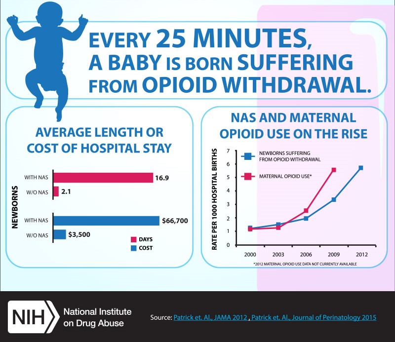 Born Addicted Neonatal Abstinence Syndrome Trends in Neonatal Abstinence Syndrome