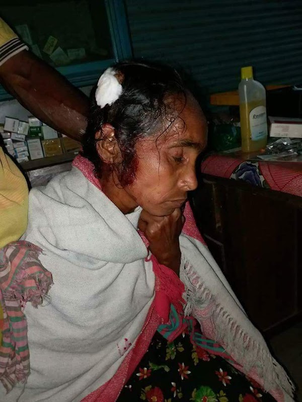 BRUTAL GRANIZADA EN BANGLADESH DEJA 8 MUERTOS y 100 HERIDOS. BRUTAL GRANIZADA EN BANGLADESH DEJA 8 MUERTOS y 100 HERIDOS.
