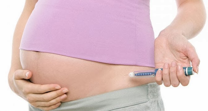 diabetes pada ibu hamil