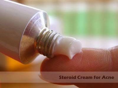 cortisone cream for acne