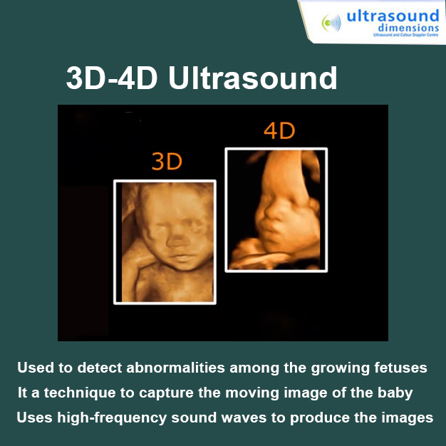 3D and 4D ultrasound