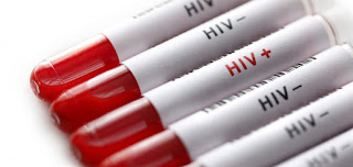 Millenials Tumataas Ang Bilang Ng May HIV
