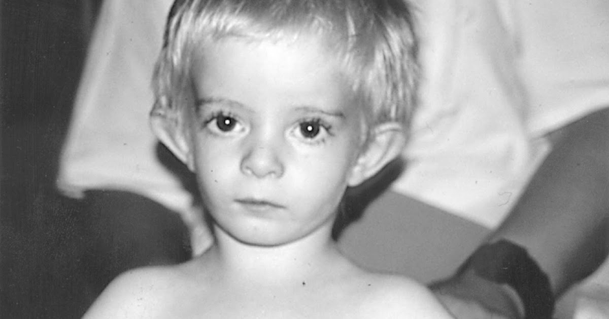 One half of your body bigger than the other