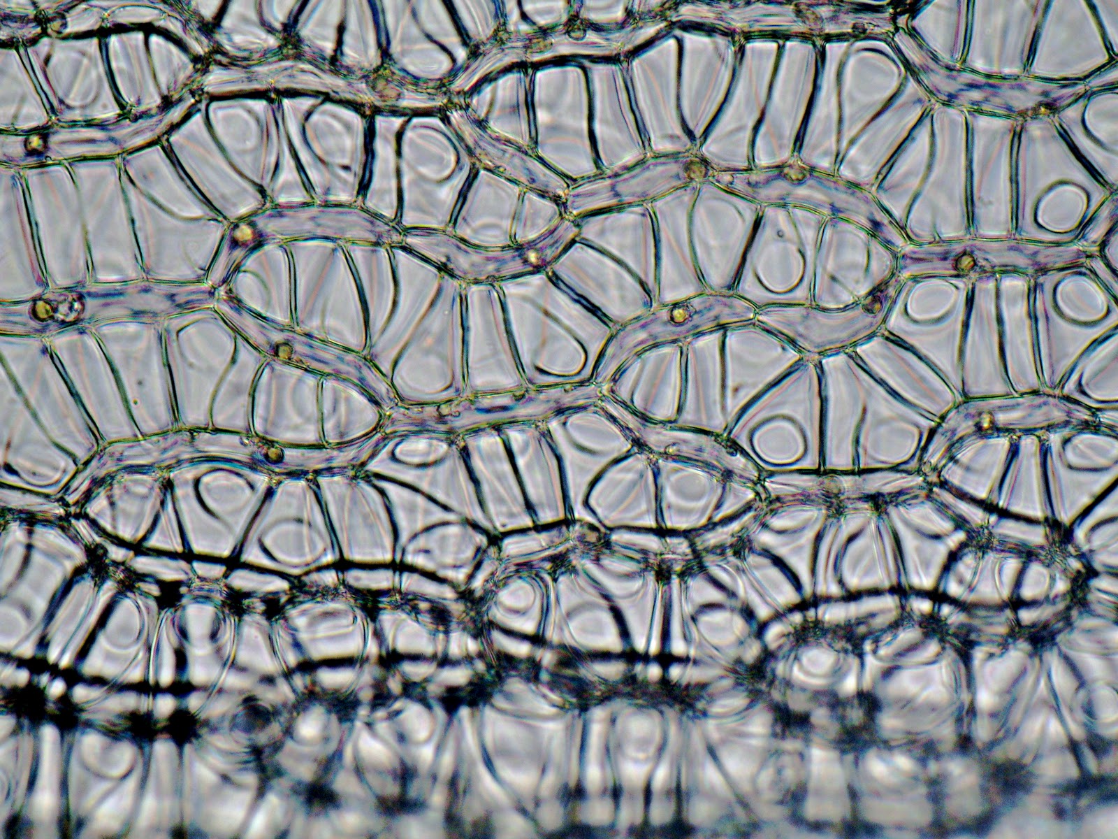 Клетка без воды. Элодея канадская под микроскопом. Клетки мха сфагнума под микроскопом. Клетка элодеи канадской. Клетки элодеи канадской под микроскопом.
