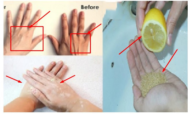 Subhanallah Rahasia Resep Terbesar Yang Disembunyikan Selama Ini Ternyata Begini Cara Memutihkan Tangan Dan Kaki Yang Paling Mujarab Hanya Dalam 1 Hari Berikut Penjelasanya Tolong Dibagikan Info Penting Ini Artikel Kesehatan