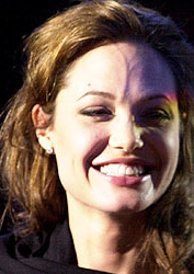 list of celebs: List of Celebs with a Big Forehead Vein