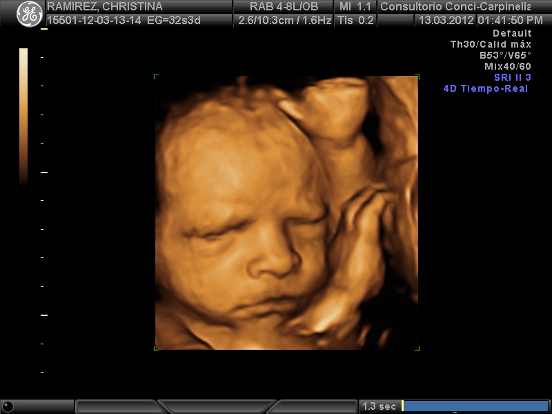 gael-4d-ultrasound-ecografia-4d