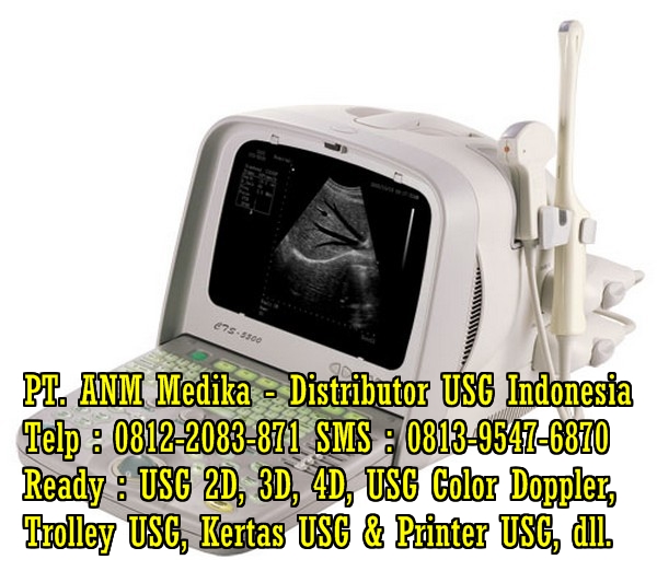 Harga USG Mindray Dc 8 Harga-usg-esaote