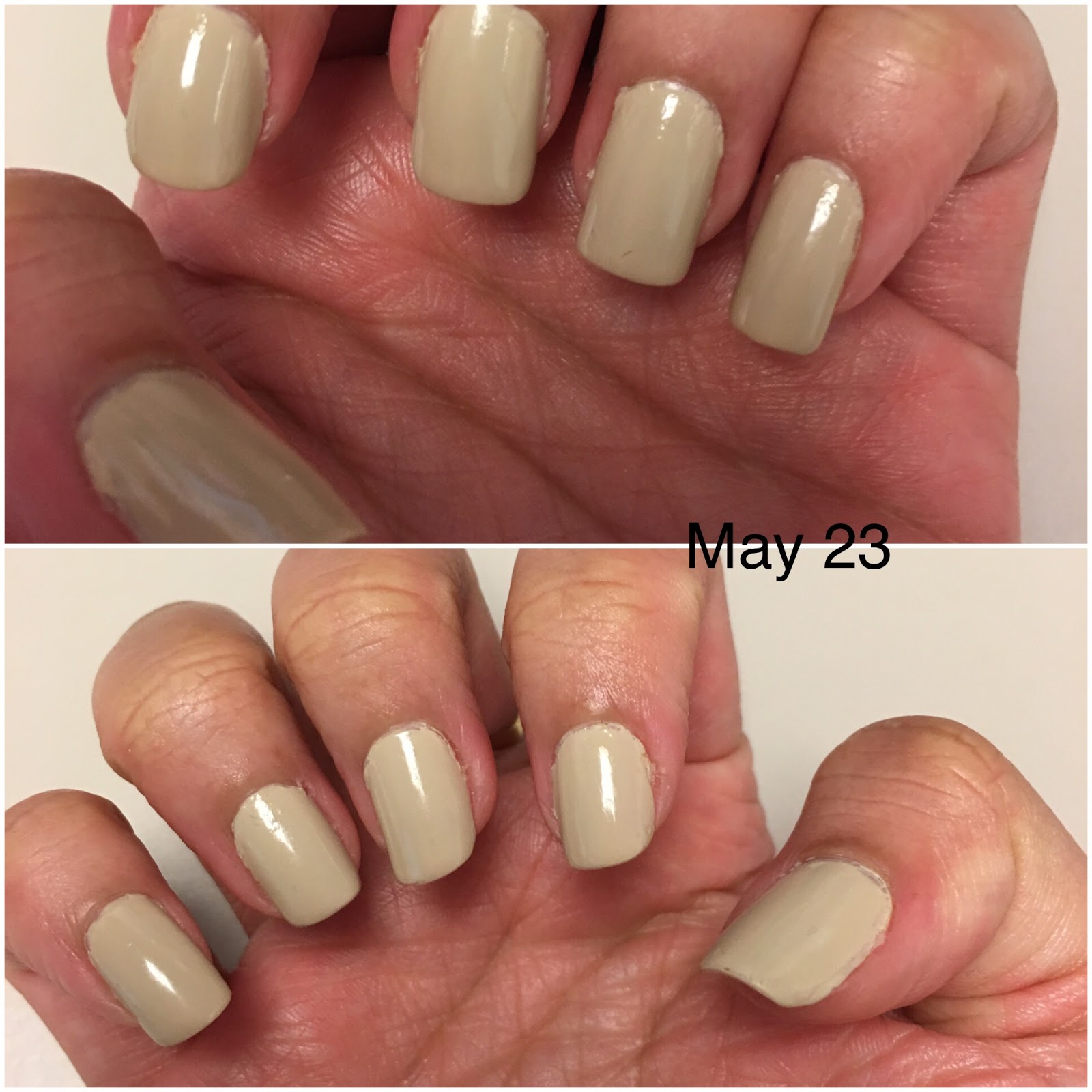 How to Save and Regrow Nails After a Break