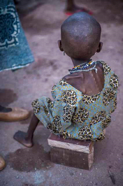 Una desnutrida niña africana con piel y huesos