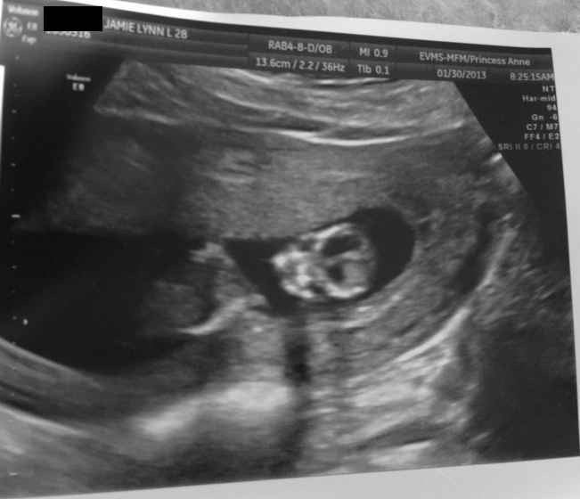 Oh, baby! Ultrasound 12 weeks 1 day