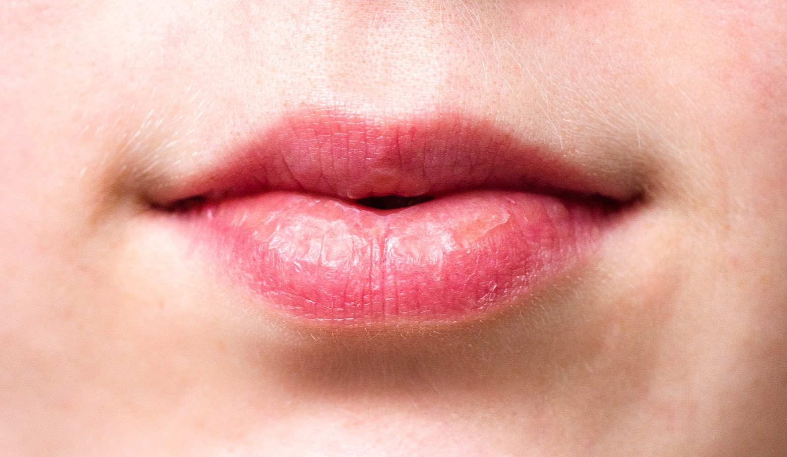 11 Penyebab Bibir Kering Yang Tidak Anda Sadari