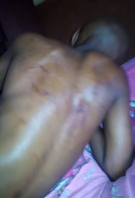 1 Photos: 11-year-old boy brutally assaulted and thrown out onto the streets by stepmother in Lagos