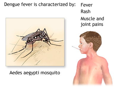 Dengue Ek Janleva Bimari