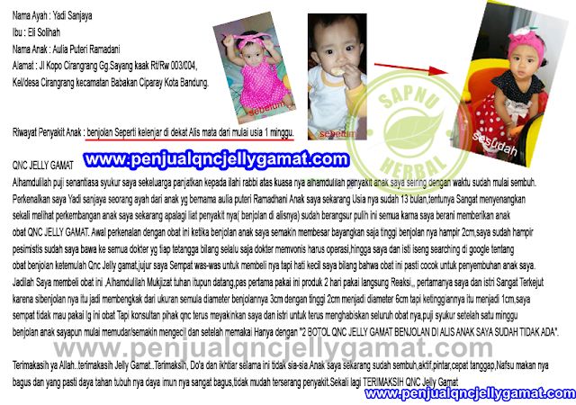 Obat Benjolan Di Kepala Tradisional, Terbukti Sembuh Tanpa Operasi & Kemoterapi Obat Benjolan Di Kepala Tradisional, Terbukti Sembuh Tanpa Operasi & Kemoterapi
