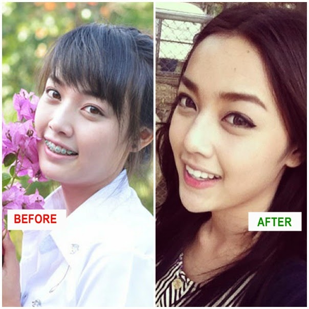 My Image 55