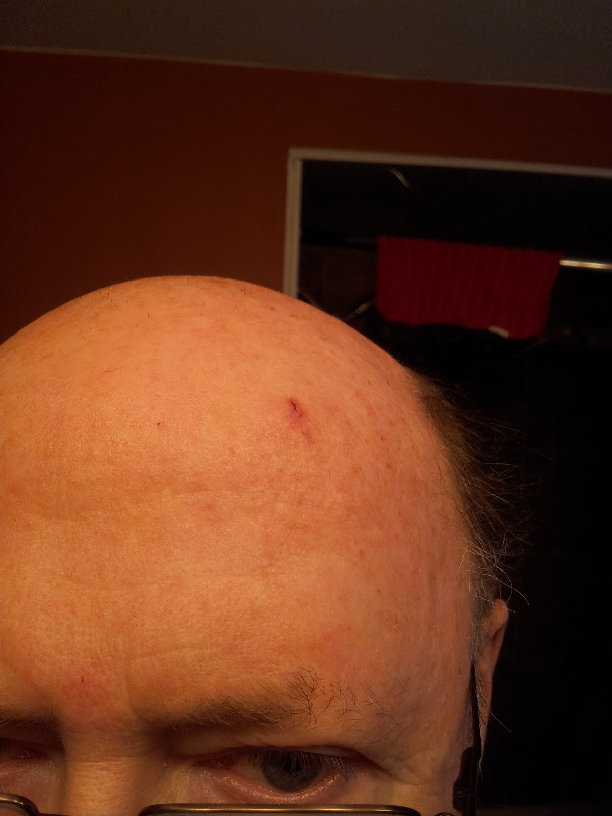 Neanderings Bump On My Head