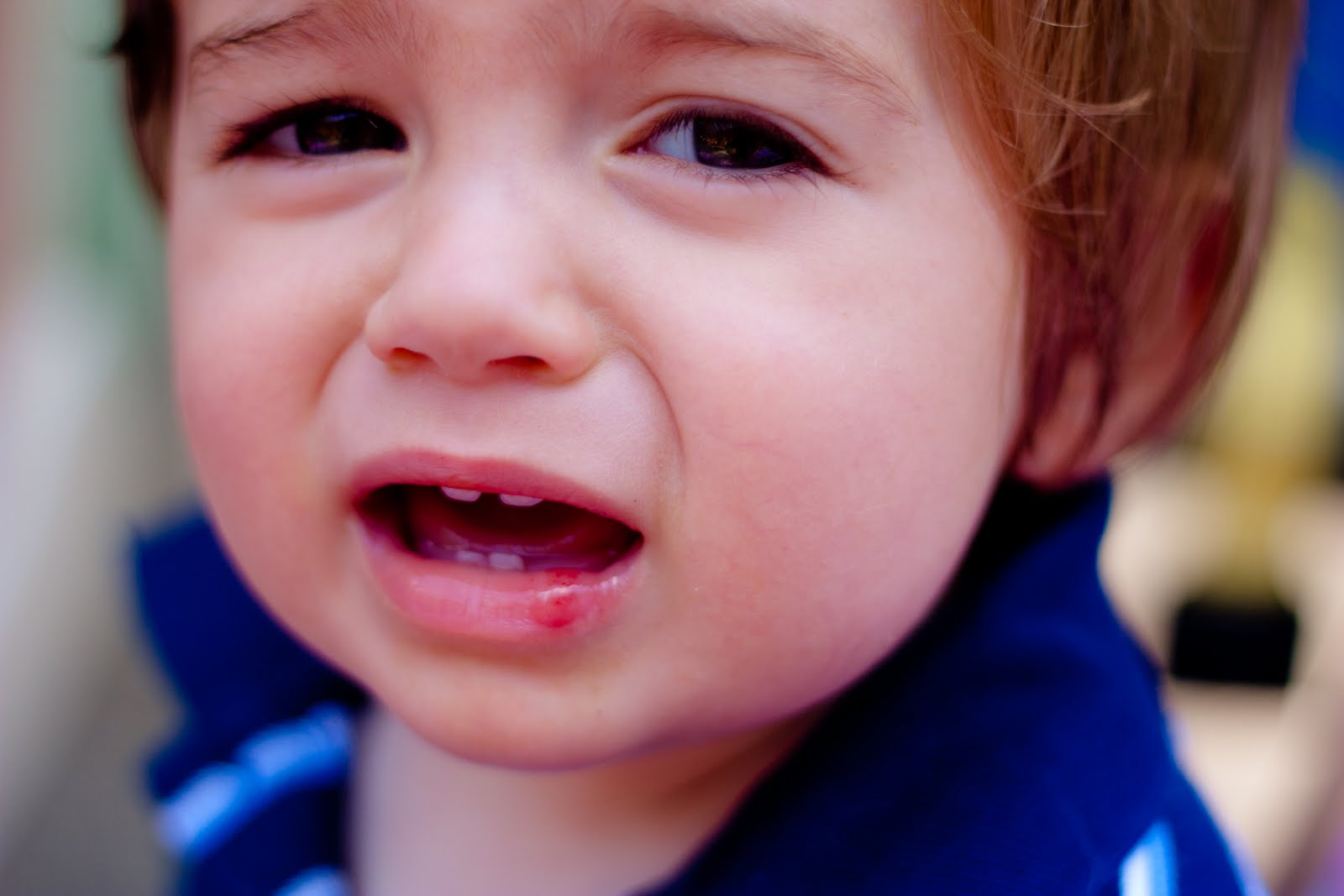 The Edwards Busted Lip