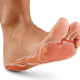 Is athlete's foot contagious | Vesicular athlete's foot vs Moccasin athlete's foot