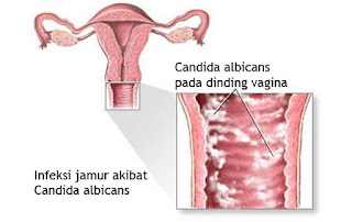Merapatkan vagina yang mulai kendur secara alami tradisional