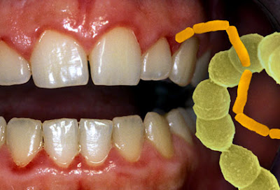 أهم الأطعمة للقضاء على جراثيم الفم