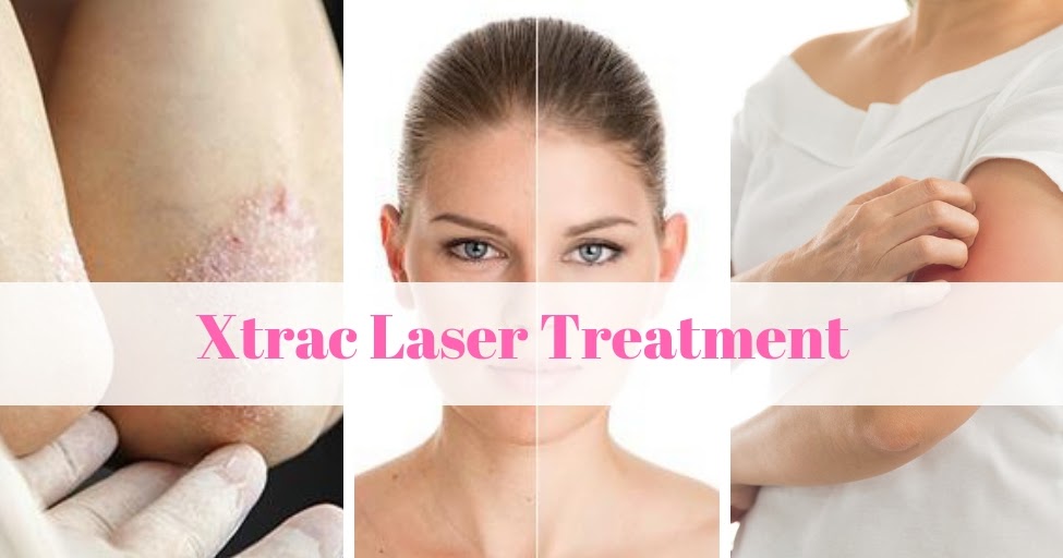 love-your-skin-what-benefits-can-expect-from-xtrac-laser-treatment