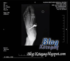 x-ray kaki
