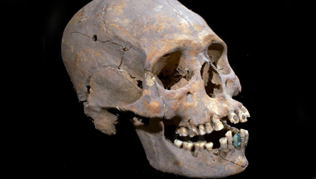 1,600-Year-Old Elongated Skull with Stone-Encrusted Teeth Found in Mexico Ruins  Skull