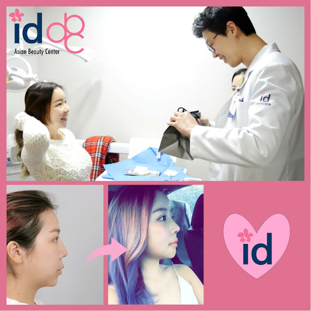 ID Hospital Korea Chenelle revisits Id Hospital Korea! korea plastic