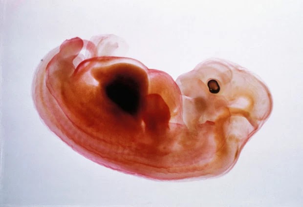 embrion humano mono