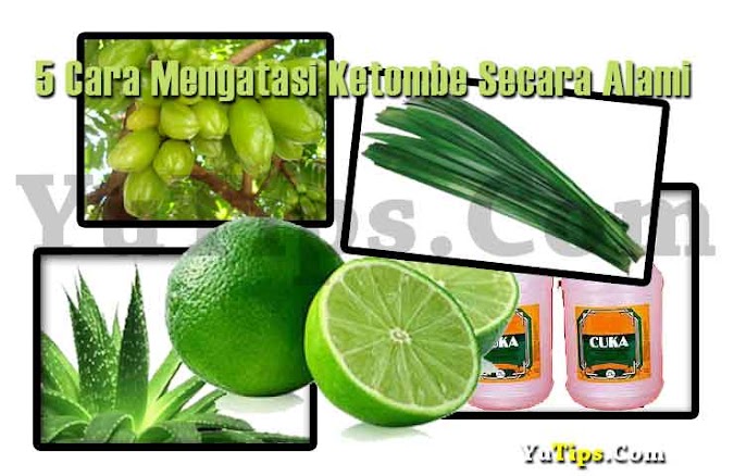 5 Cara Cepat & Alami Mengatasi Ketombe