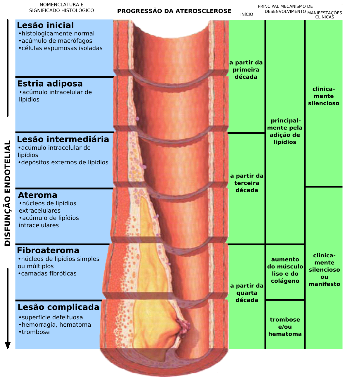Which Arteries Are Most Commonly Affected By Atherosclerosis Which Arteries Are Most Commonly Affected By Atherosclerosis