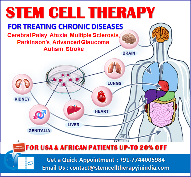 India Is Providing Access To Stem Cell Therapy For Treating Chronic