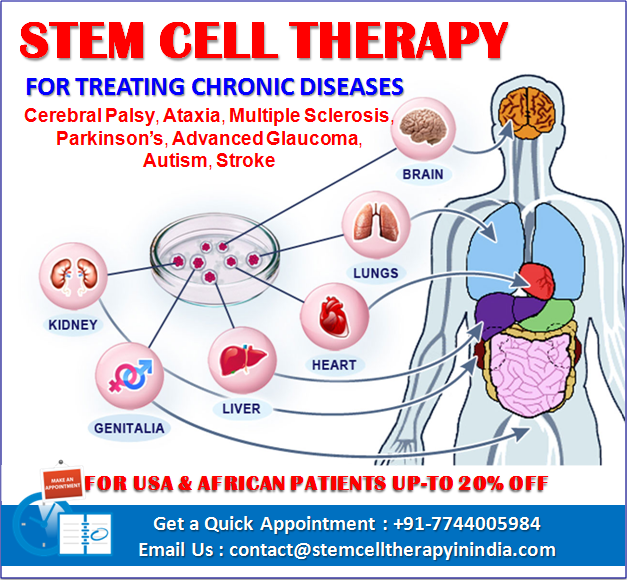 best stem cell treatment in the world