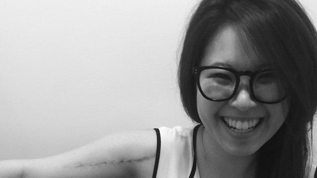 #WeLoveOvey | Ovey Yeung Loves You Back | hit-and-run victim | Scars Are Beautiful