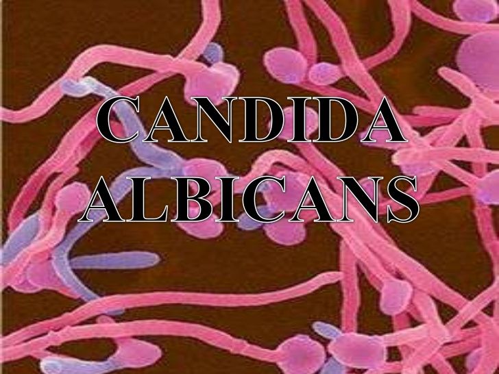 Candida albicans лечение. Корпус альбиканс.
