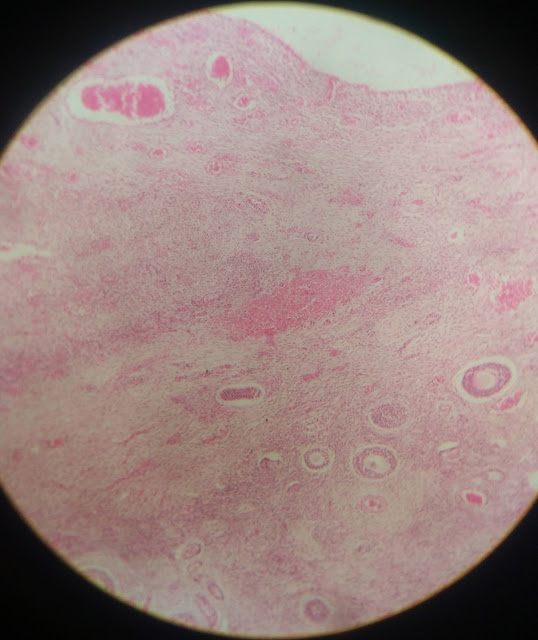 histology slide of ovary