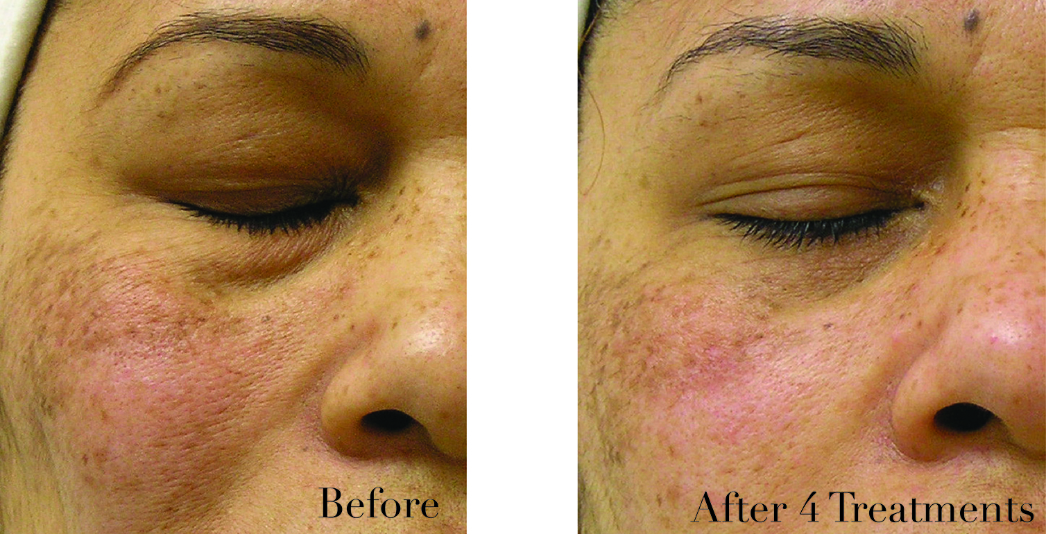 Advanced Skincare 101 Why Does The Skin On My Face Feel Heavy and How