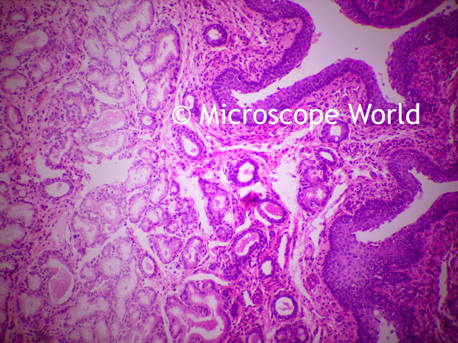 100x esophagus under microscope